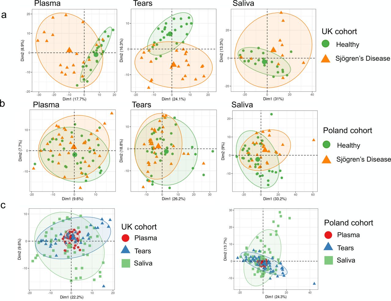 l glutathione and sjogren's syndrome Sjögren's disease metabolome reveals biomarker signatures to characterise patients assess disease activity Current and future therapies for